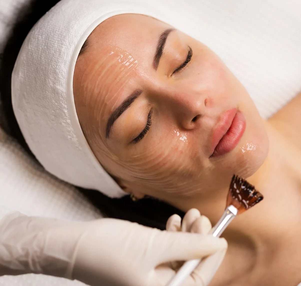 Obagi Skin Peels