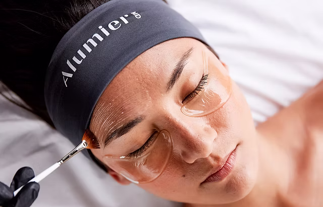 Alumier Peels